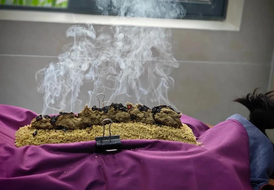 三九天灸超全攻略,赶紧码住!